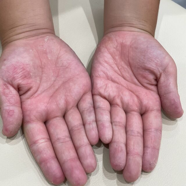 Amazon.co.jp: ライフコーポレーション トルコ産 手で皮がむけるオレンジ 1袋 : 食品・飲料・お酒