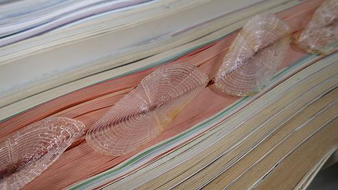 危険⚠生物!!!!!見つけても絶対に触らないで下さい!! カツオノカンムリ カツオノエボシ 危険 毒