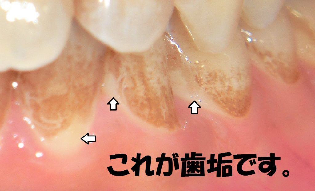 鈴木歯科クリニック-診療内容