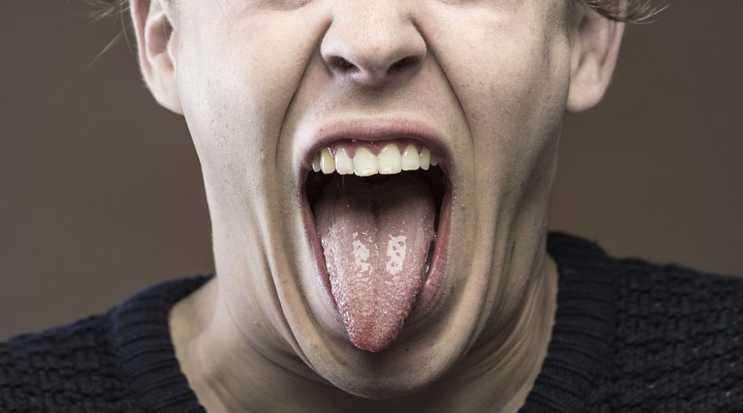 パイナップルの赤斑病の治療方法は